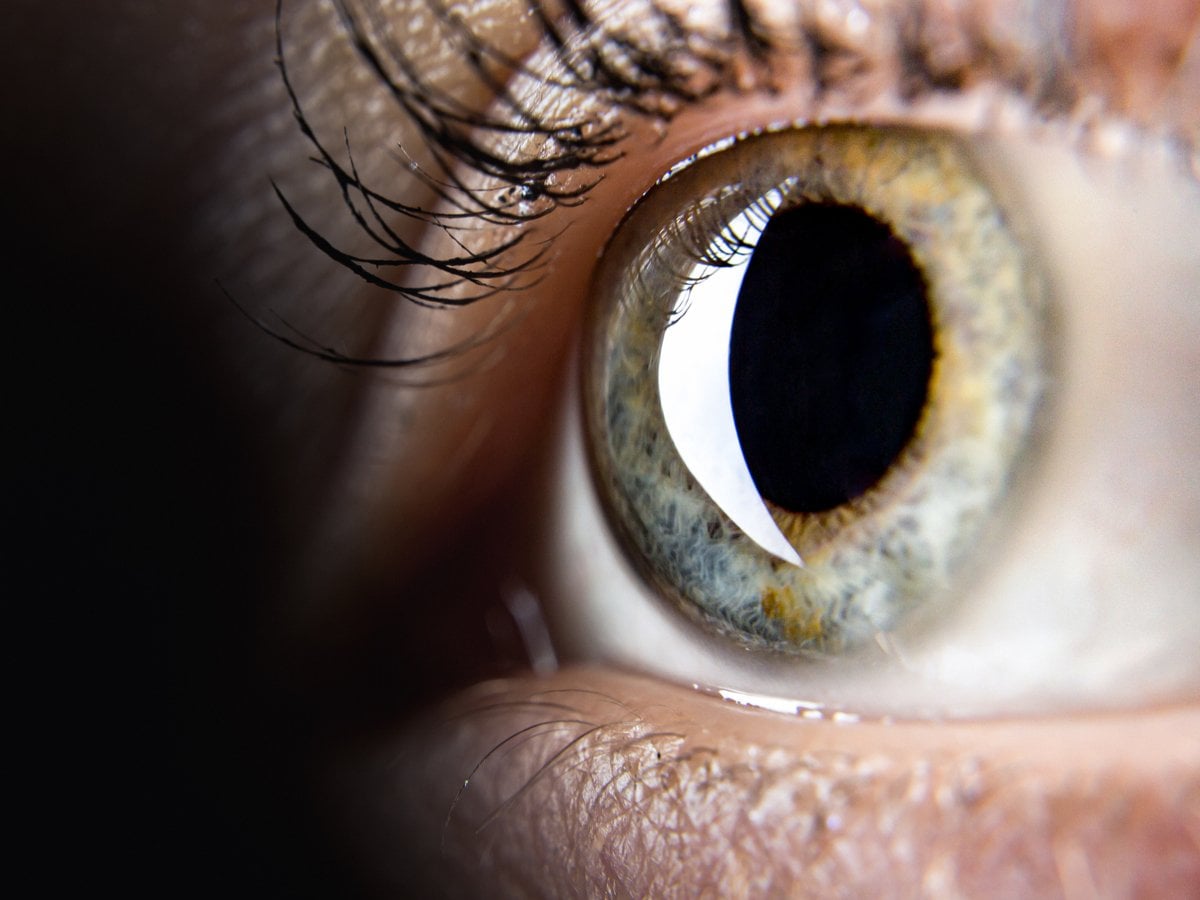 En närbild av en persons öga.