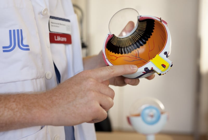 En läkare med läkarrock håller i en modell av ett öga