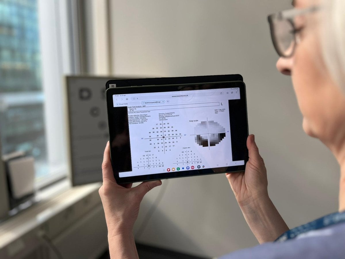 En kvinna med glasögon tittar på en surfplattas skärm. På bilden syns en horisontell och vertikal linje och olika siffor, ett resultat av en patients synfält.