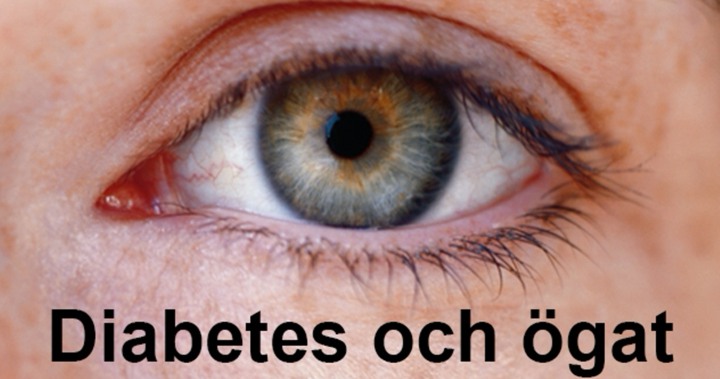 Diabetes-och-ogat-thumbnail-padda720x379
