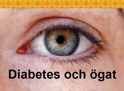 Diabetes-och-ogat-thumbnail_mobil-m432x319