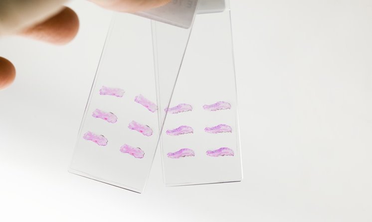 Två små rektangulära glasskivor med vävnadsprov